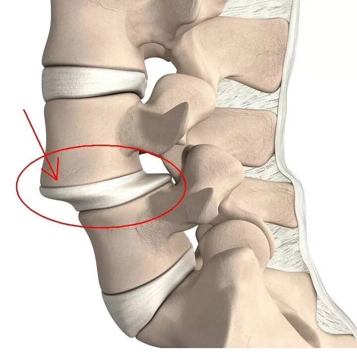 lesões vertebrais