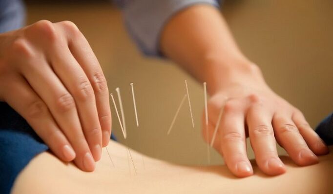 acupuntura para tratar a dor lombar